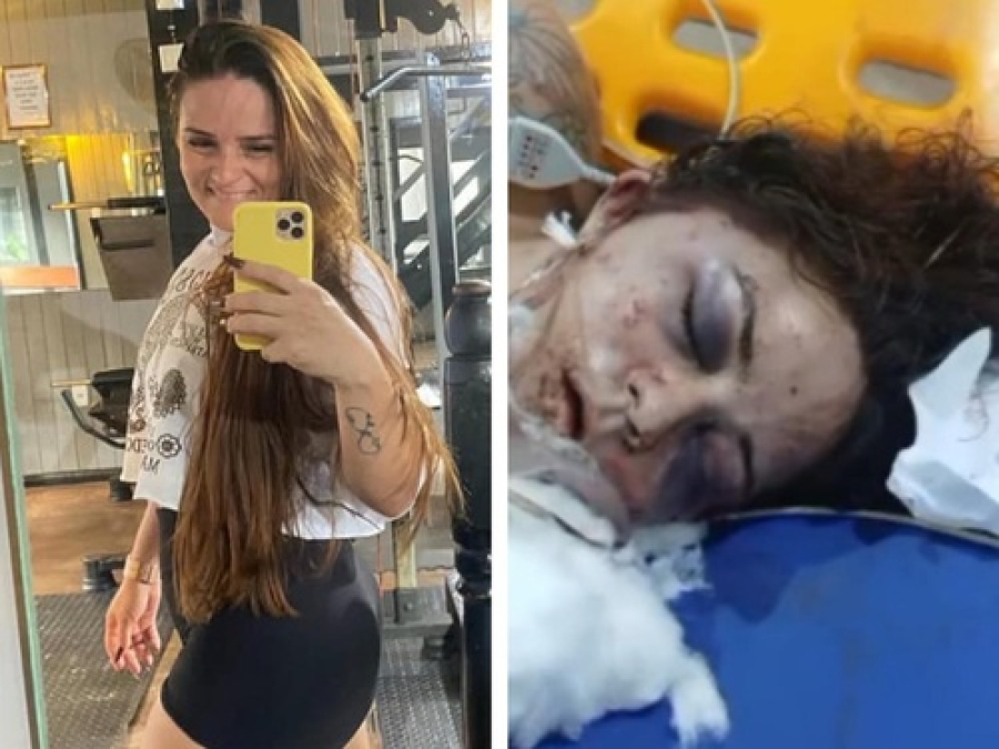 Mulher agredida com socos, morre no Pará.