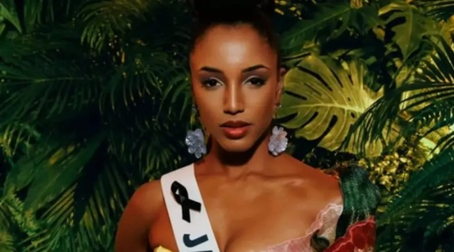 Miss Jamaica recebe alta hospitalar depois de 4 meses.