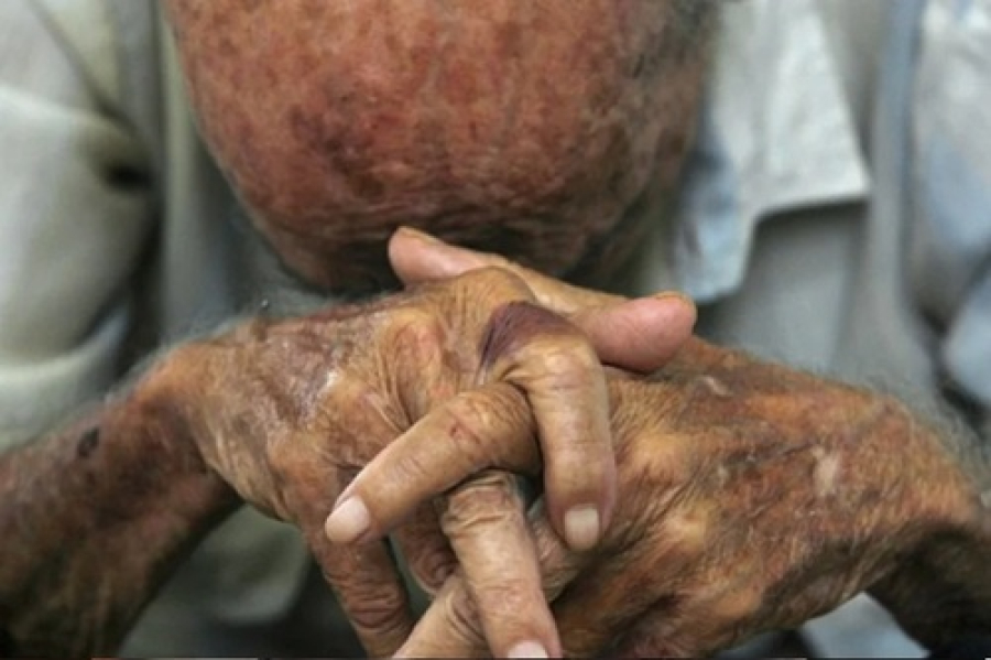 Policia prende suspeitos de violência contra idoso