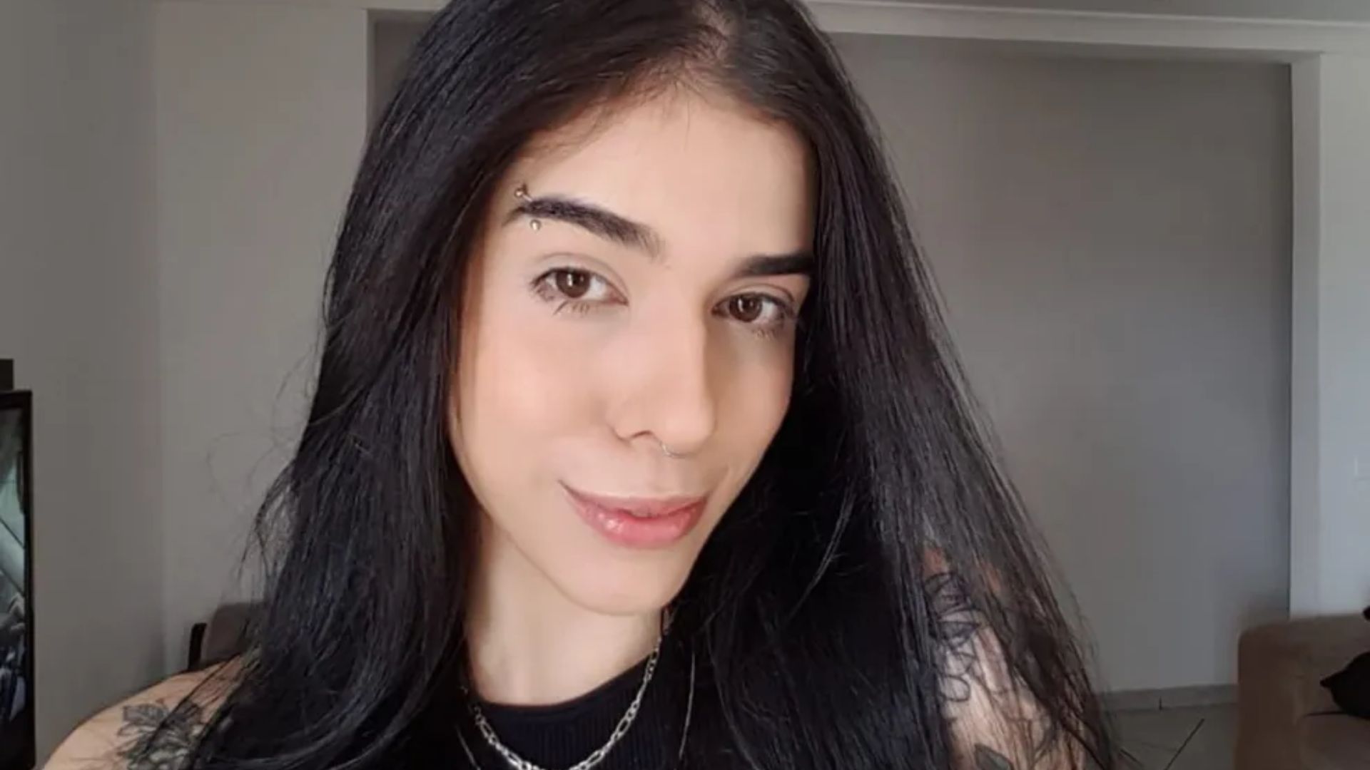 Jovem que teve reação alérgica volta pra UTI