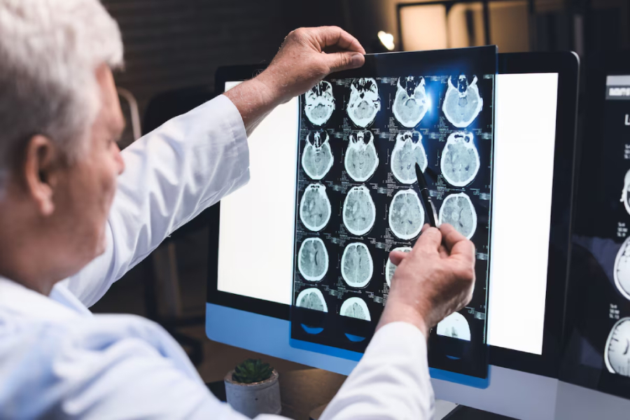 Primeiro remédio contra o Alzheimer chega ao Brasil