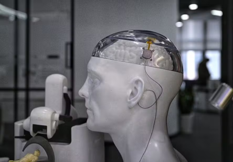 China comercializa o primeiro implante cerebral