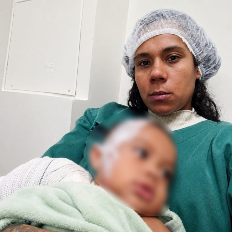 Polícia Civil investiga caso de bebê queimado com água em creche