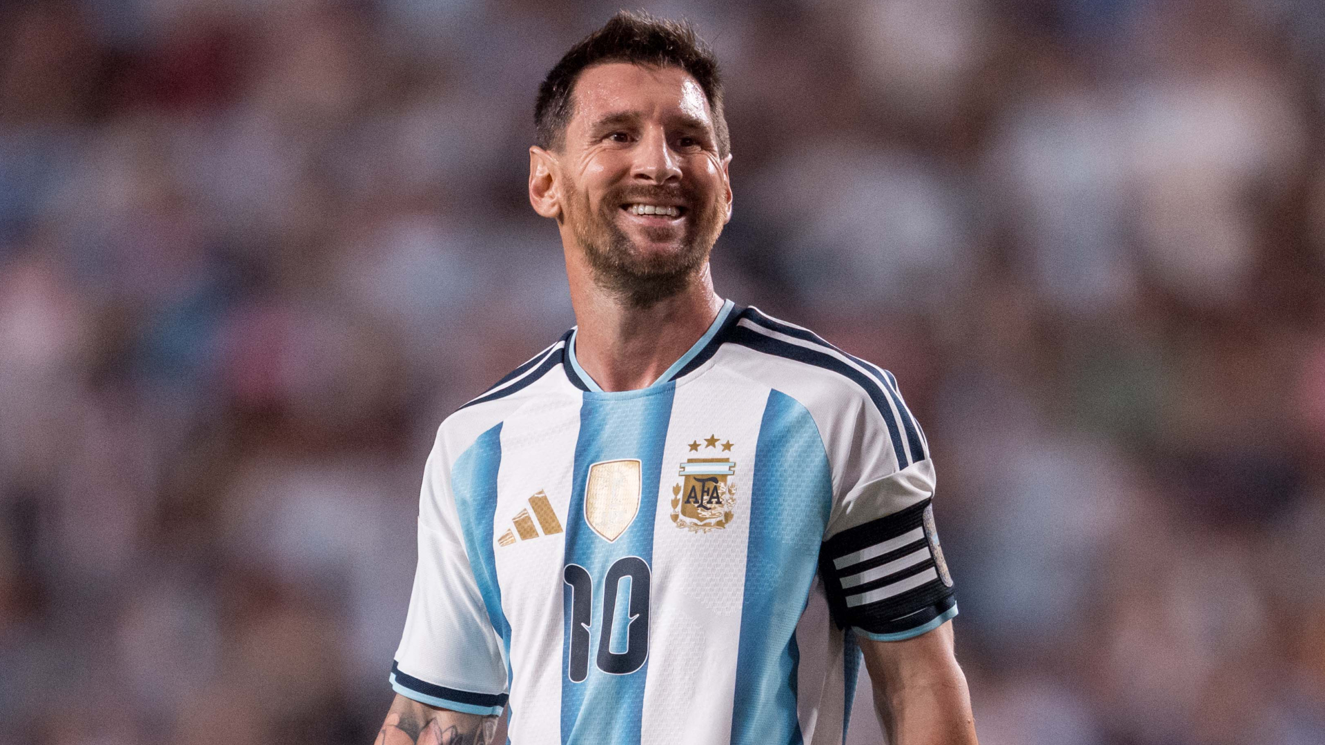 Messi com galo enorme na cabeça.