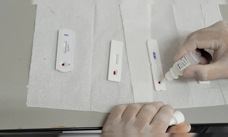 Diagnóstico tardio eleva mortes por Aids na região 