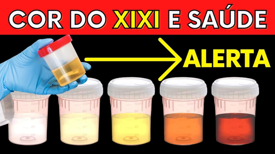 O que a cor da sua urina fala sobre a sua saúde?