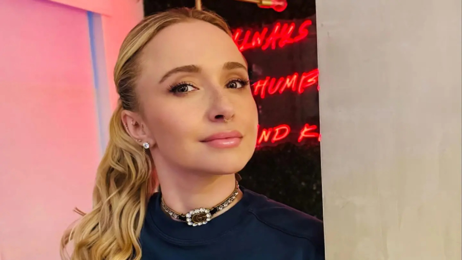 Causa da morte da atriz Hayden é revelada 