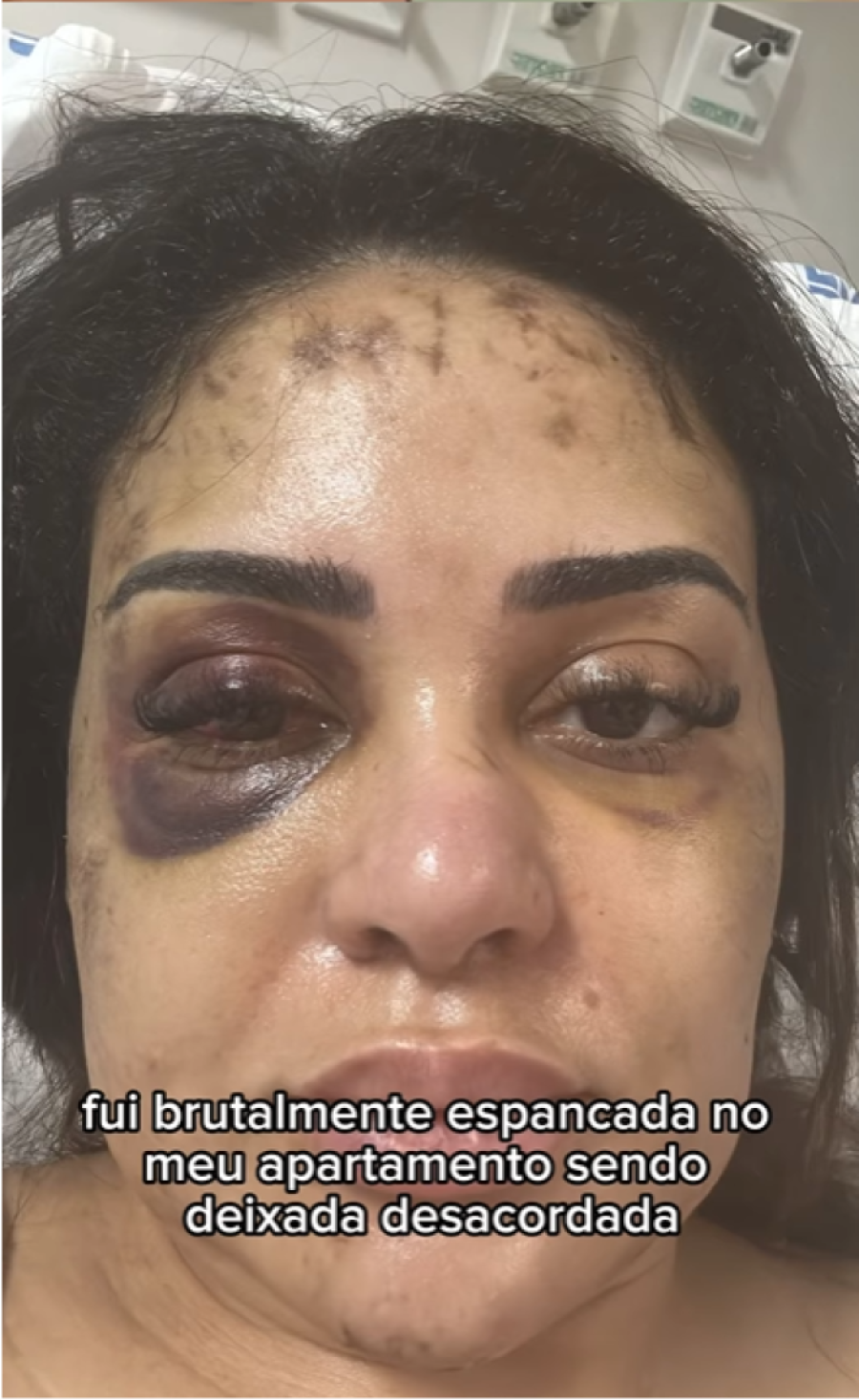 Médica foi espancada pelo namorado em Maringá