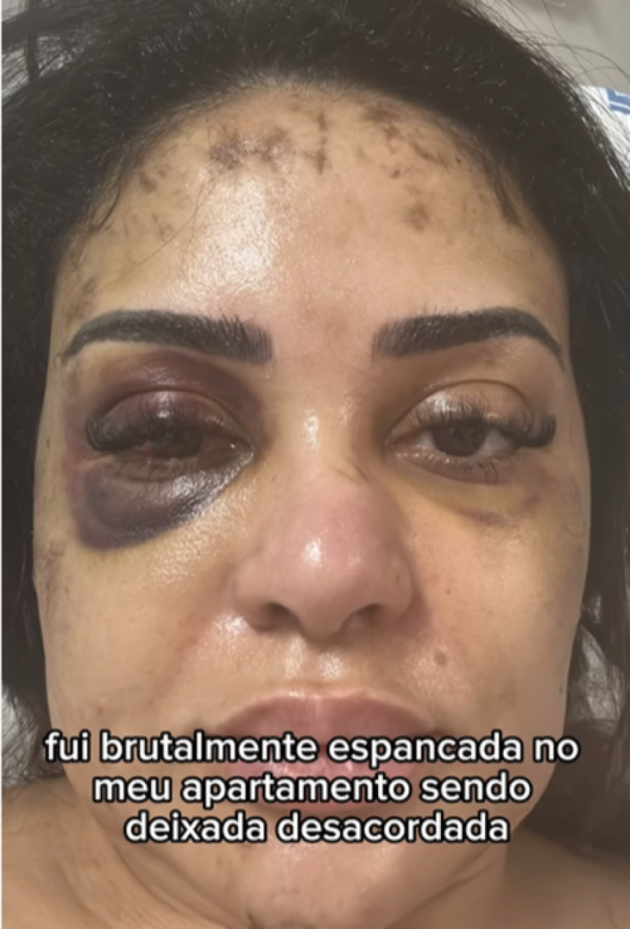Preso o agressor da médica Laize