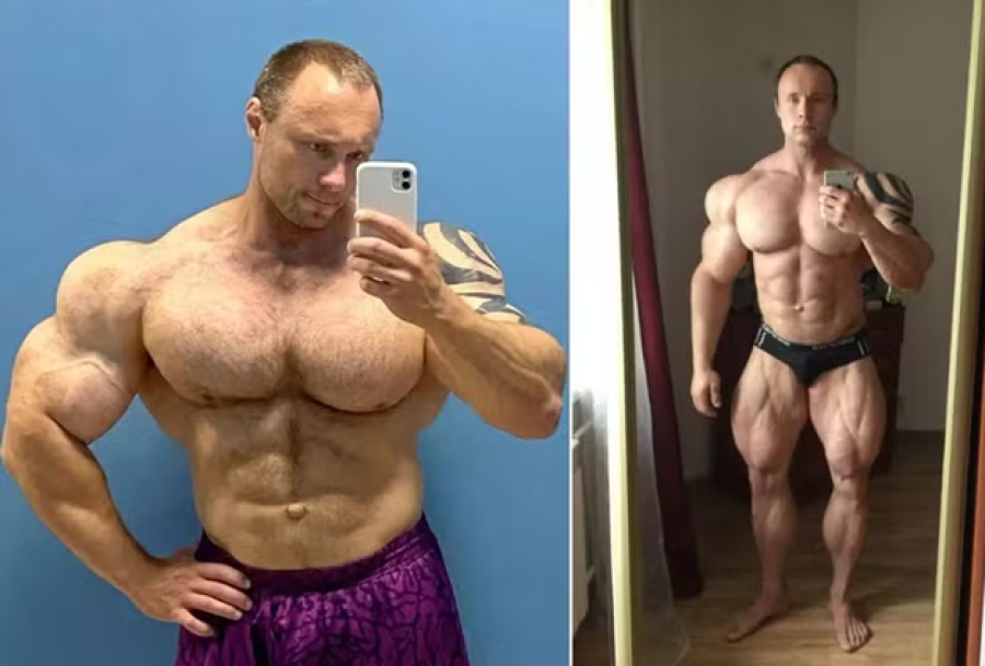 Fisiculturista morre aos 35 anos após injeções. 