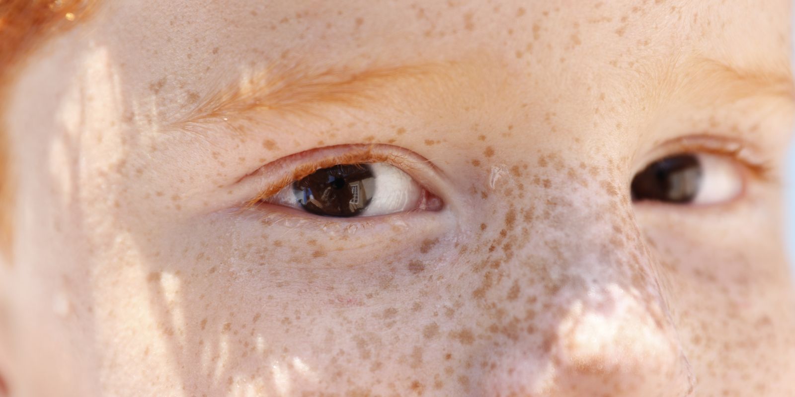 Reflexo branco nos olhos: entenda esta condição.