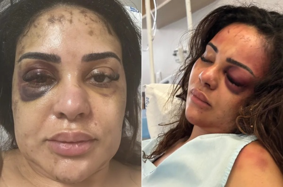 Arquivado denúncia de agressão contra ex-namorado de médica.